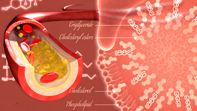 Cholesterol_770x433.png